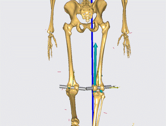 KneeModel_GIF3_back