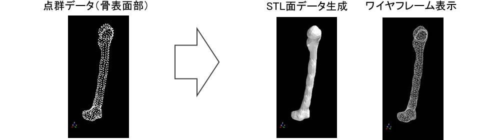 骨の表面形状データを作成する機能