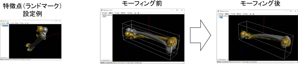 患者骨形状の反映機能（モーフィング自動編集機能）